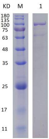 12% SDS-PAGE analysis profiles of purified PA3535-31-995 (CBB stained).